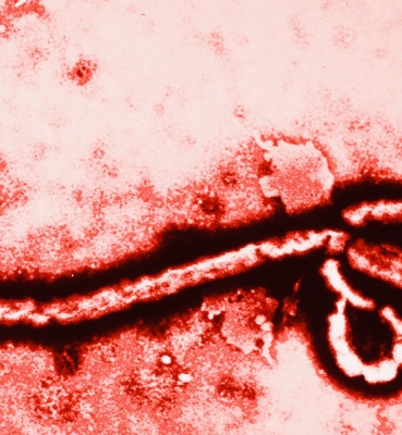 Lo que usted debe saber sobre el virus del Ébola