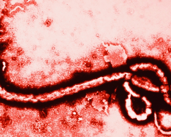 Lo que usted debe saber sobre el virus del Ébola