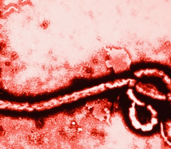 What You Should Know About the Ebola Virus