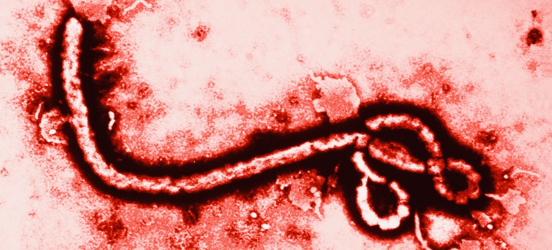 What You Should Know About the Ebola Virus